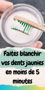 Faites blanchir vos dents jaunies en moins de 5 minutes