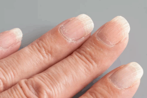 Rendre Vos Ongles Rugueux, Durs et Plus Doux