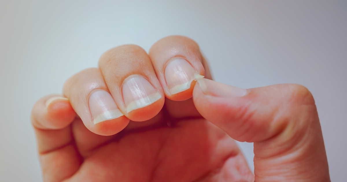  prévenir la casse des ongles