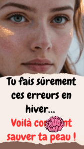 Comment prendre soin de sa peau en hiver