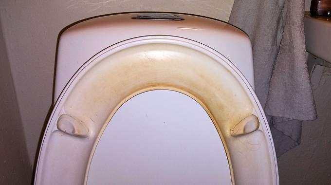 Comment éliminer naturellement les taches jaunes sur un abattant WC